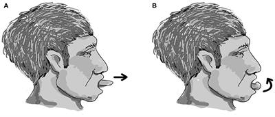 Home-Based Orolingual Exercise Improves the Coordination of Swallowing and Respiration in Early Parkinson Disease: A Quasi-Experimental Before-and-After Exercise Program Study